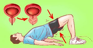 Exercicio para prostatite