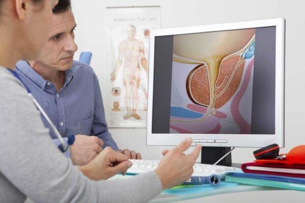 O médico consulta ao paciente sobre o tema da prostatite